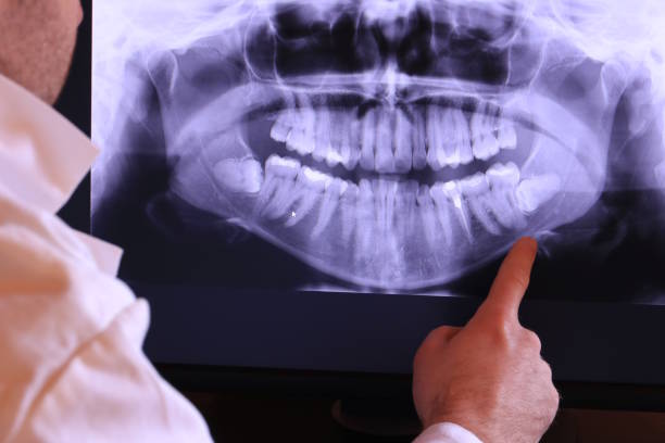 Best Weekend Emergency Dentist in Lake Secession, SC