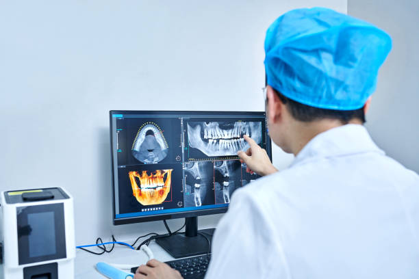 Best Emergency Treatment for Dental Infections or Abscesses in Lake Secession, SC