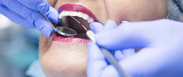 Best Emergency Dental Care for Broken or Chipped Teeth in Lake Secession, SC